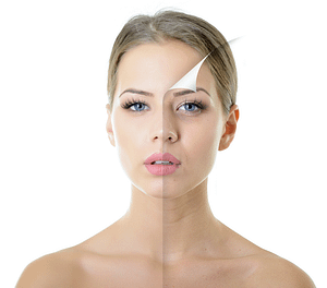 Skin Rejuvenation Treatments in Mississauga That Restore Your Glow