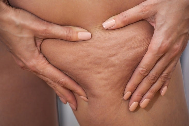 Say Goodbye to Cellulite with Body FX: The Revolutionary Solution for Smooth, Toned Skin