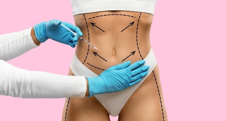 Transform Your Body with Body Contouring