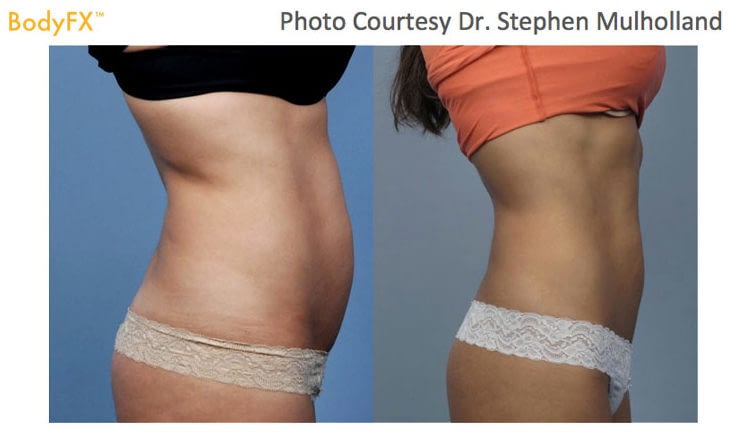 Get the Best Body Contouring Near Me At The Lowest Price.