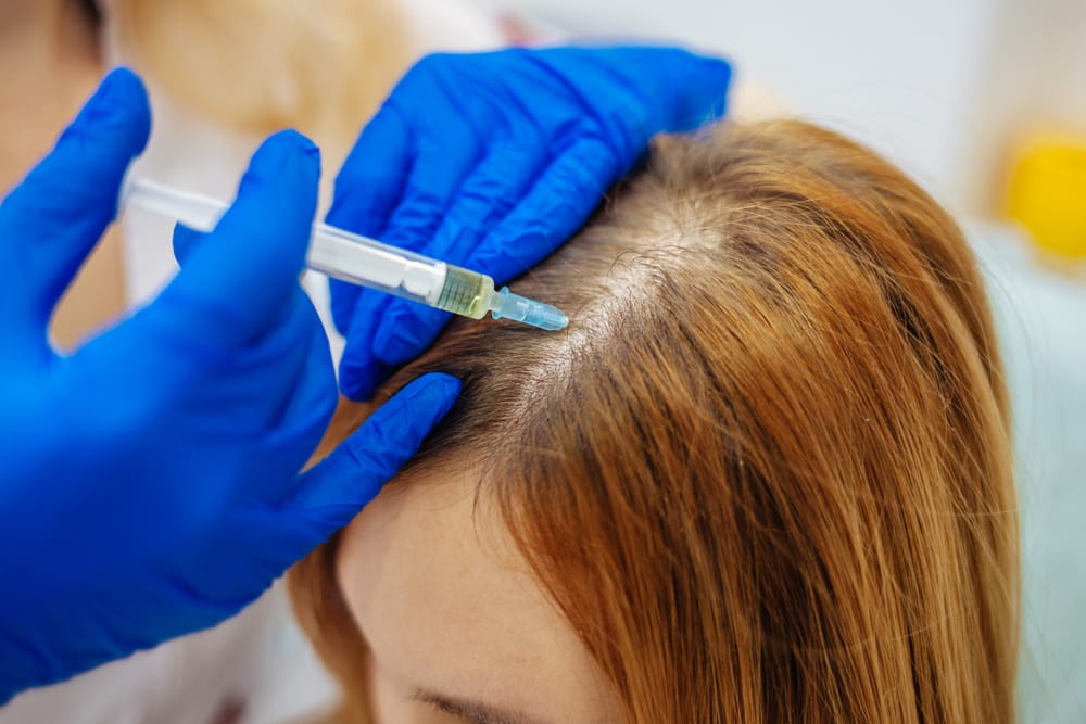 Stem Cell Therapy for Hair Loss: What You Don't Know?