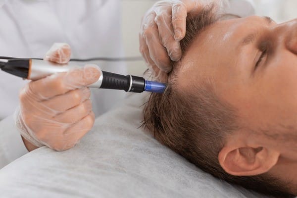Exosome Hair Growth Treatment