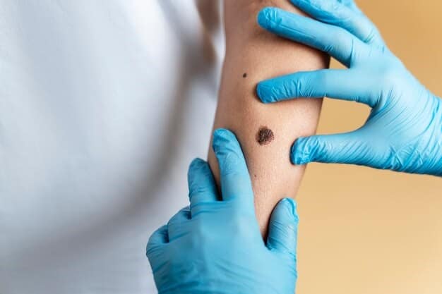Wart Removal Laser Treatment