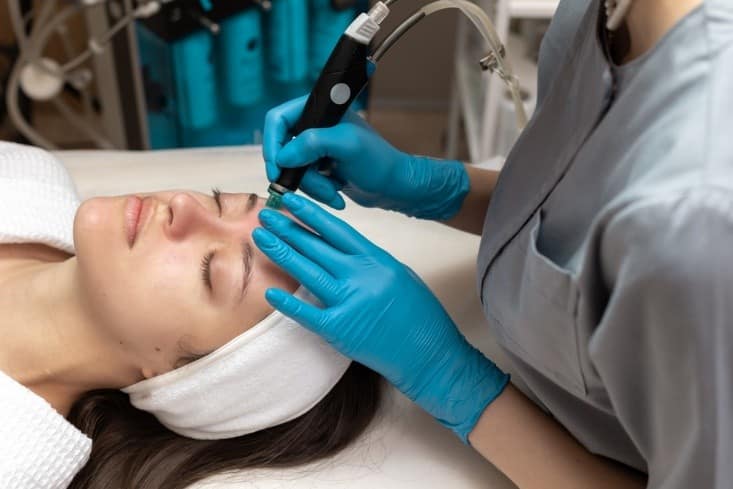How Hydrafacial Targets Acne Wrinkles and Dark Spots