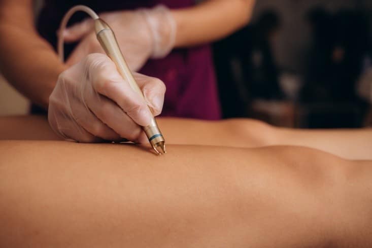 How Laser Vein Treatment Helps Restore Healthy Looking Legs