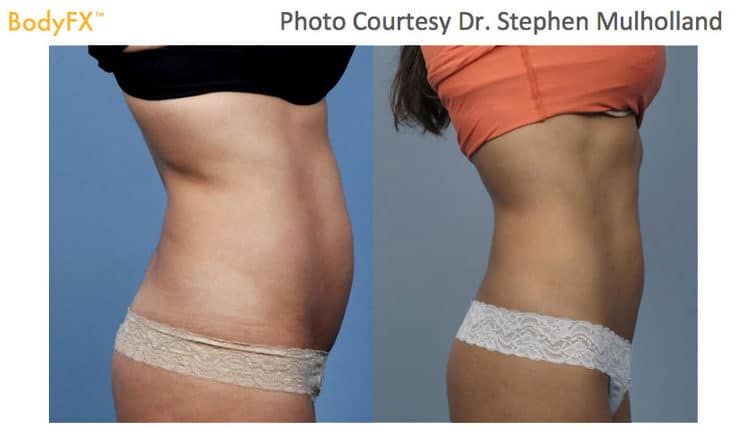 bodyfx Ba e1533928826259
