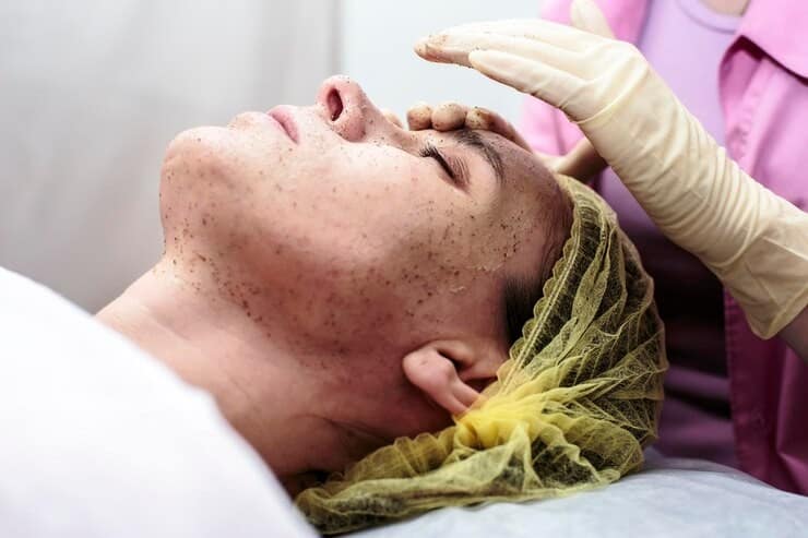 hyperpigmentation treatment for face