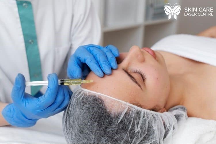 PRP Treatment for Face